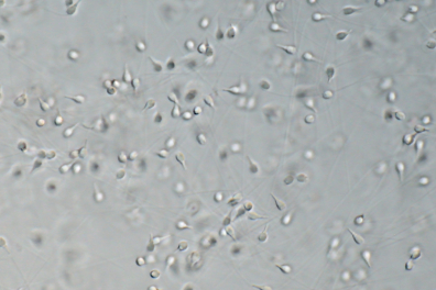 Spermatozoïdes de Moule x200